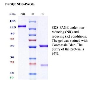 Recombinant Neurofilament (NF-L) (Neuronal Marker) Antibody in SDS-PAGE