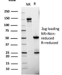 ATP5F1A Antibody in SDS-PAGE
