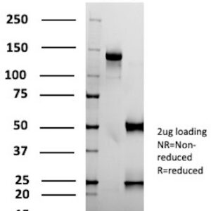 ATP5F1A Antibody in SDS-PAGE