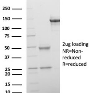 Phosphatidylcholine translocator ABCB4 Antibody in SDS-PAGE