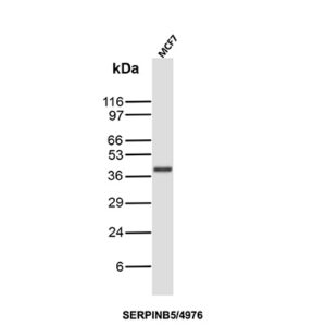 SERPINB5 Antibody in Western Blot (WB)