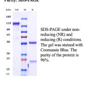 Recombinant Interleukin-20 receptor subunit alpha Antibody in SDS-PAGE