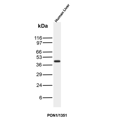 Western blot analysis of human liver tissue lysates using PON1 Mouse Monoclonal Antibody (PON1/1351). PON1 Antibody in Western Blot (WB)