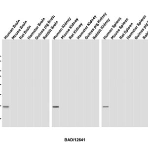 BAD Antibody in Western Blot (WB)