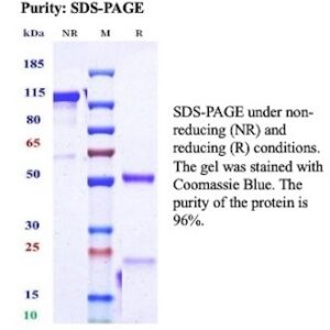 Recombinant Interleukin-21 Antibody in SDS-PAGE