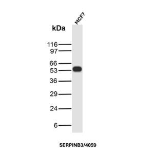 SERPINB3 Antibody in Western Blot (WB)