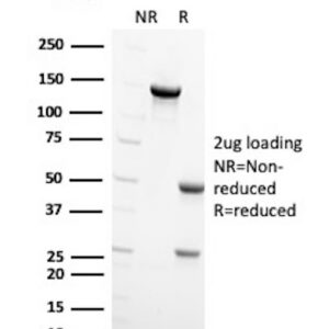 Beta-sarcoglycan Antibody in SDS-PAGE