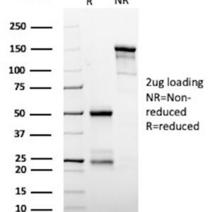 Gamma-synuclein Antibody in SDS-PAGE