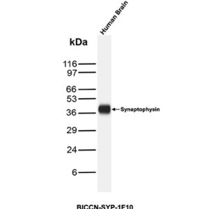 Antibody in Western Blot (WB)