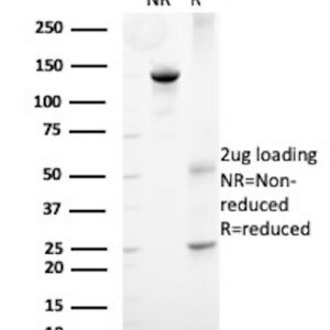Synaptophysin (Neuroendocrine Marker) Antibody in SDS-PAGE