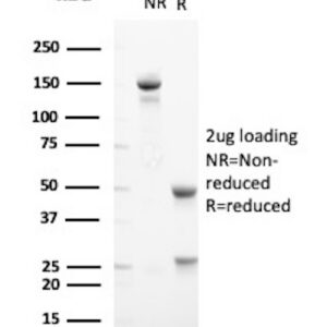 Synaptophysin (Neuroendocrine Marker) Antibody in SDS-PAGE