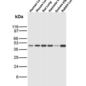 TCF4 Antibody in Western Blot (WB)