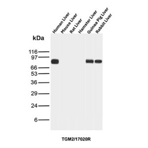 TGM2 Antibody in Western Blot (WB)