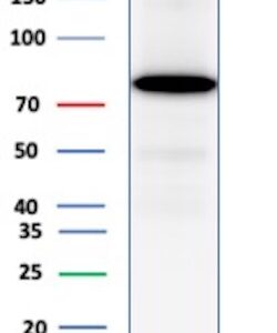 TGM2 Antibody in Western Blot (WB)