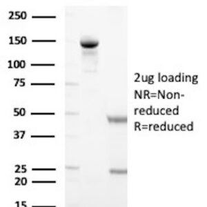 Tyrosine Hydroxylase (Marker of Peripheral Neuroblastic Tumors) Antibody in SDS-PAGE