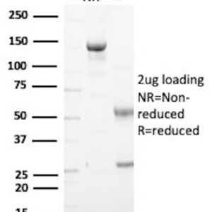 Tyrosine Hydroxylase (Marker of Peripheral Neuroblastic Tumors) Antibody in SDS-PAGE