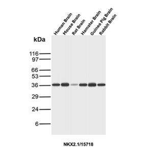 NKX2.1 Antibody in Western Blot (WB)
