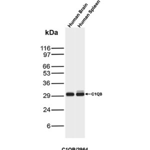 MSM4 Antibody in Western Blot (WB)