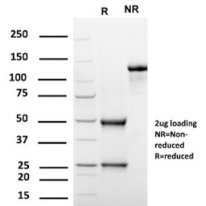 PGP9.5 / UchL1 (pan-Neuronal Marker) Antibody in SDS-PAGE