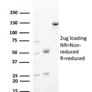 PGP9.5 / UchL1 (pan-Neuronal Marker) Antibody in SDS-PAGE
