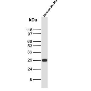 CA3 Antibody in Western Blot (WB)