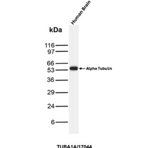 TUBA1A Antibody in Western Blot (WB)