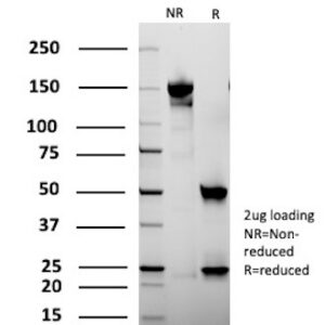 CAMK2A Antibody in SDS-PAGE