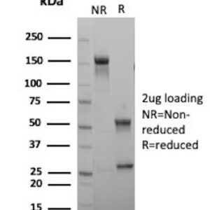 Protein phosphatase 1 regulatory subunit 1B Antibody in SDS-PAGE