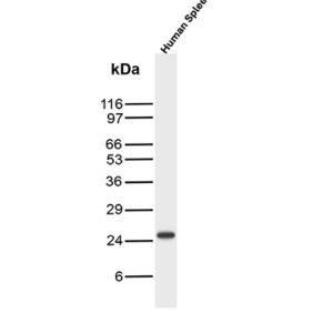CD3e Antibody in Western Blot (WB)