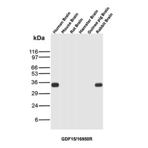 GDF15 Antibody in Western Blot (WB)
